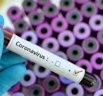 الصحة السعودية: تسجيل 61 إصابة جديدة بفيروس كورونا